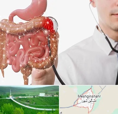 دکتر سرطان روده بزرگ در مشگین شهر