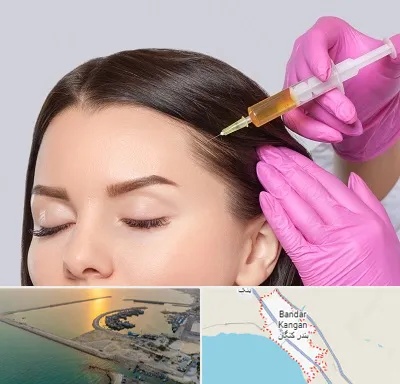 تزریق هیر فیلر در بندر کنگان
