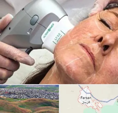 آموزش هایفوتراپی در فارسان