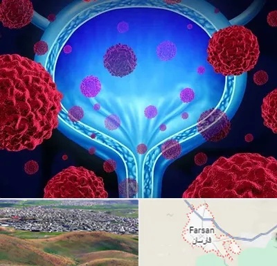 دکتر سرطان مثانه در فارسان