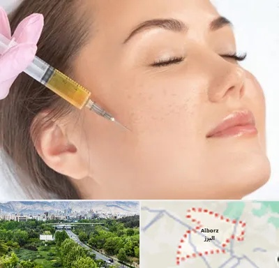 آموزش تزریق ژل و بوتاکس در البرز