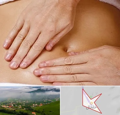 متخصص ناف گیری در خلخال