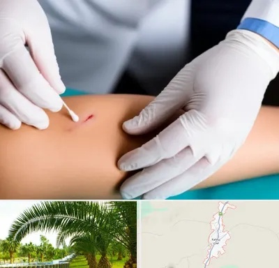 متخصص زخم عفونی در کهنوج