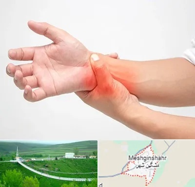 دکتر متخصص دست در مشگین شهر
