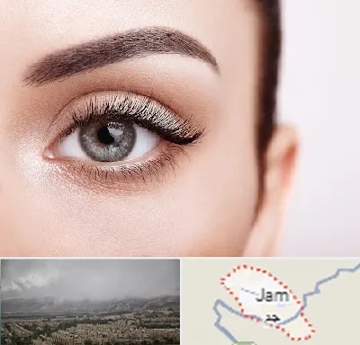 فوق تخصص عنبیه در جم