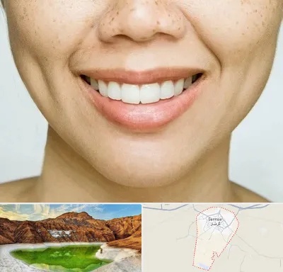 عمل چال گونه در گرمسار