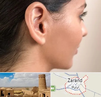 عمل گوش بل در زرند