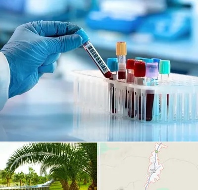 آزمایشگاه خون قبل از ازدواج در کهنوج