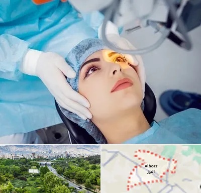 دکتر عمل لیزیک چشم در البرز