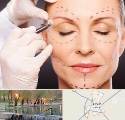 دکتر زیبایی صورت در بروجن