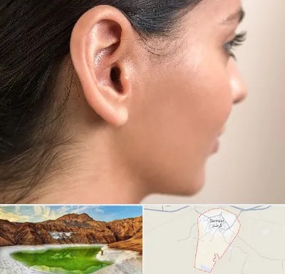 عمل گوش بل در گرمسار