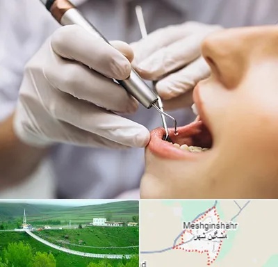 دندانپزشکی ارزان در مشگین شهر