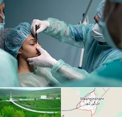 عمل بینی ارزان در مشگین شهر