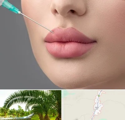 کلینیک ژل لب روسی در کهنوج