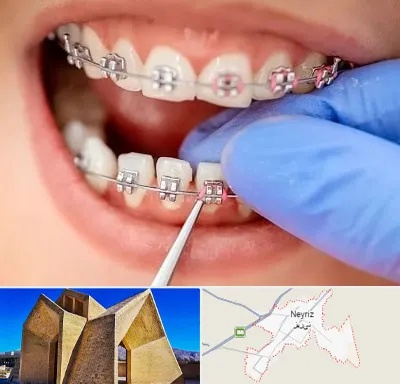 مرکز ارتودنسی دندان در نی ریز