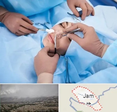 عمل بینی فانتزی در جم