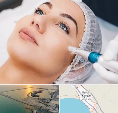 مزونیدلینگ در بندر کنگان