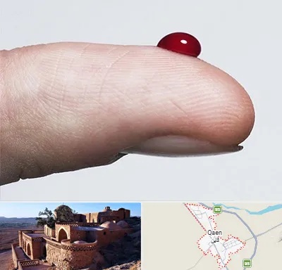 مرکز فصد خون در قائن
