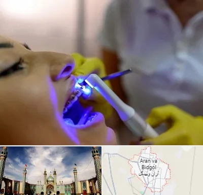 دندانپزشکی با لیزر در آران و بیدگل
