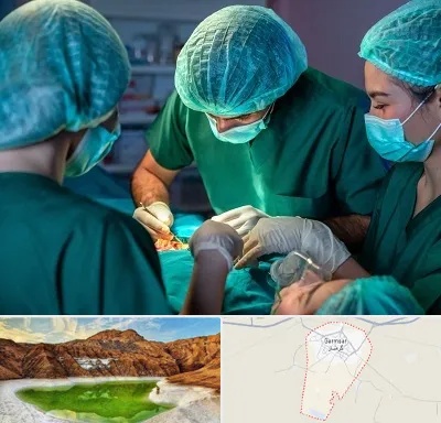عمل کوچک کردن سینه در گرمسار