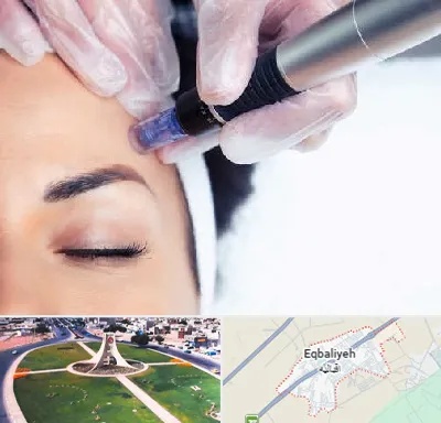 کلینیک مزوتراپی صورت در اقبالیه