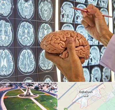 دکتر فوق تخصص جراح مغز و اعصاب در اقبالیه