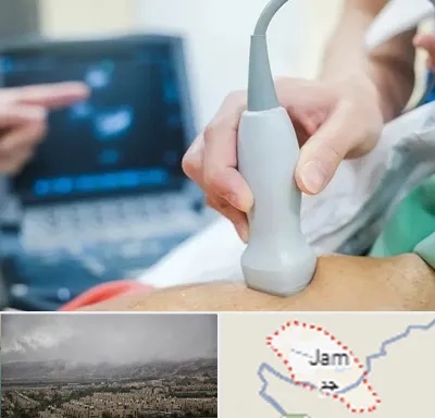 اکو قلب شبانه روزی در جم
