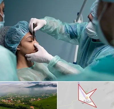 عمل بینی ارزان در خلخال