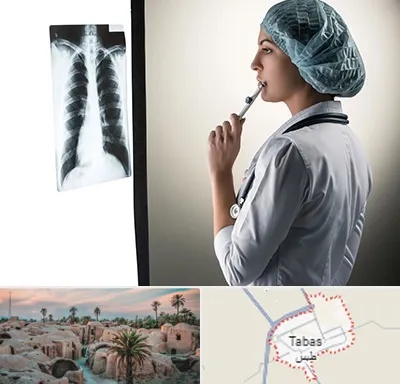 دکتر سرطان ریه در طبس
