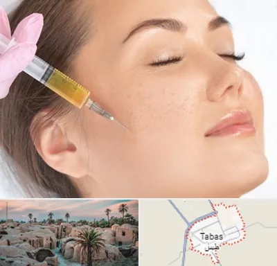 آموزش تزریق ژل و بوتاکس در طبس
