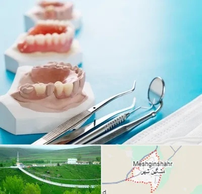 متخصص روکش دندان در مشگین شهر
