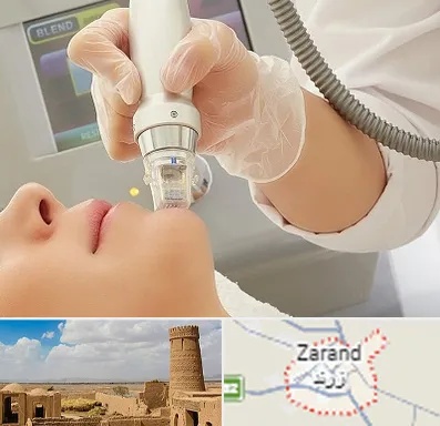 آر اف فرکشنال در زرند