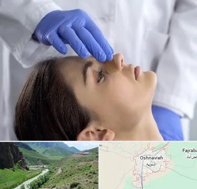 عمل بینی عروسکی در اشنویه