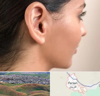 عمل گوش بل در فارسان