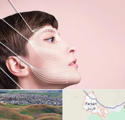 اندولیفت پیشانی در فارسان