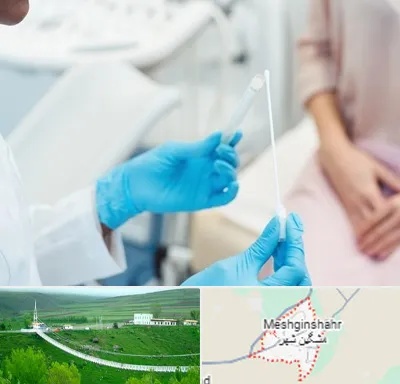 دکتر زگیل تناسلی HPV در مشگین شهر