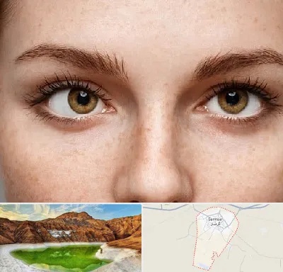 متخصص انحراف چشم در گرمسار