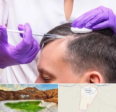 دکتر فوق تخصص پوست و مو در گرمسار