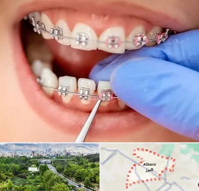 مرکز ارتودنسی دندان در البرز