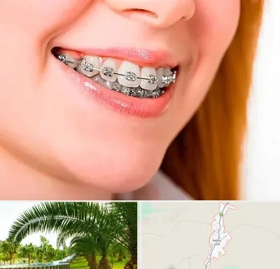 ارتودنسی ارزان در کهنوج