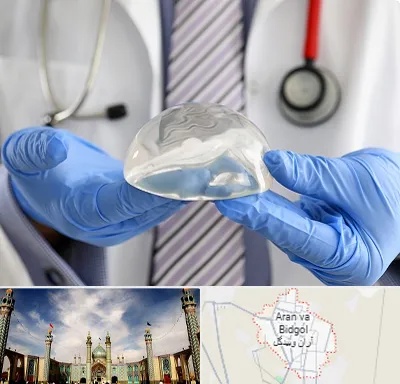 ماموپلاستی در آران و بیدگل