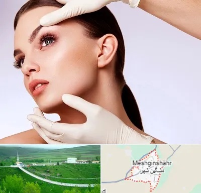 دکتر رفع غبغب در مشگین شهر