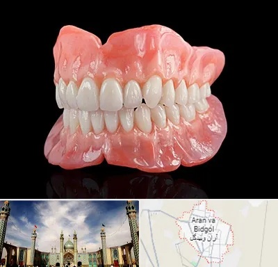 ساخت دندان مصنوعی در آران و بیدگل