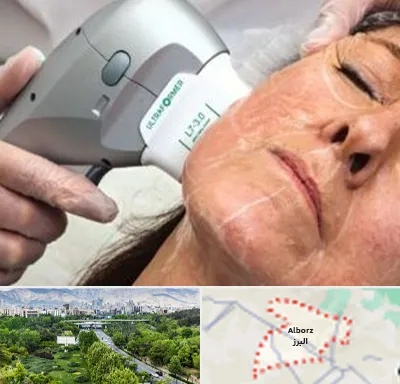 آموزش هایفوتراپی در البرز