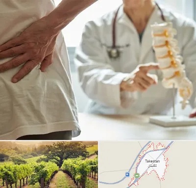 دکتر فوق تخصص ستون فقرات در تاکستان