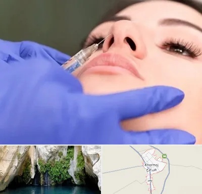 هیالاز در خورموج