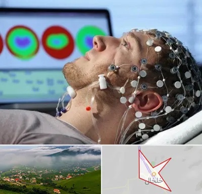 مرکز نوار مغز در خلخال