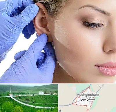 اتوپلاستی در مشگین شهر
