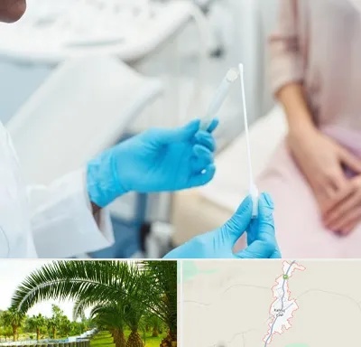 دکتر زگیل تناسلی HPV در کهنوج