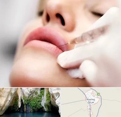 کلینیک تزریق ژل لب در خورموج